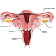 Illustration for article titled Unregulated Ovarian Cancer Test With Life-Saving Potential Is Not Without Risk